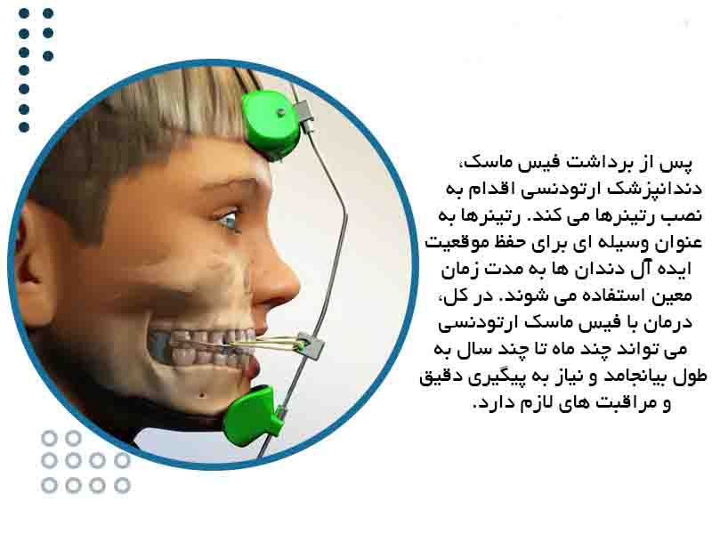 فیس ماسک ارتودنسی