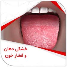 فشار خون در دندانپزشکی
