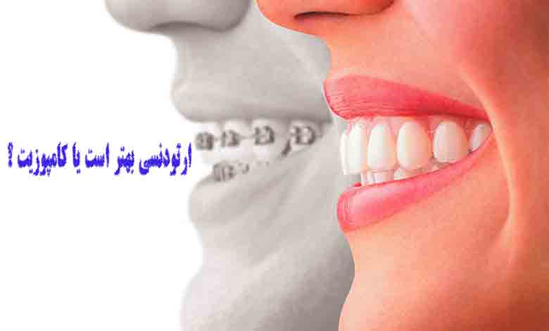 ارتودنسی بهتر است یا کامپوزیت؟
